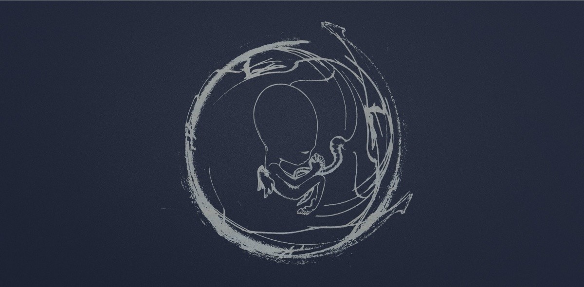 Live Audio Stream | Sigur Ros To Stream 1999 Concert