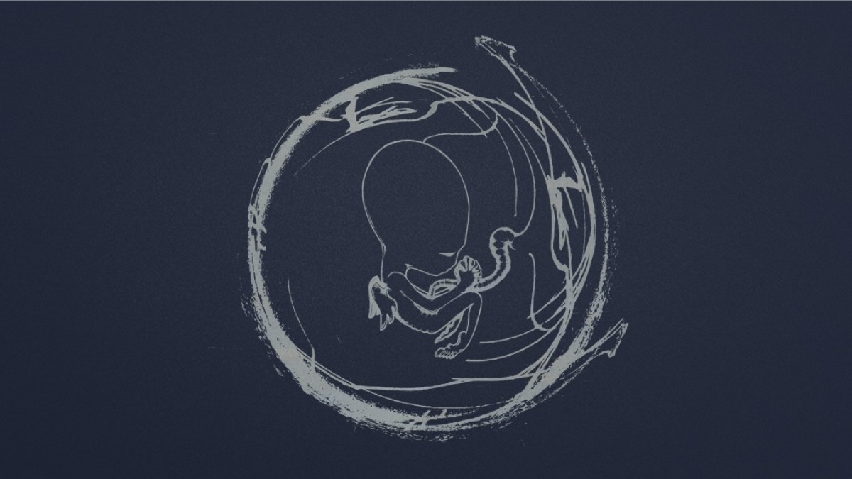 Live Audio Stream | Sigur Ros To Stream 1999 Concert