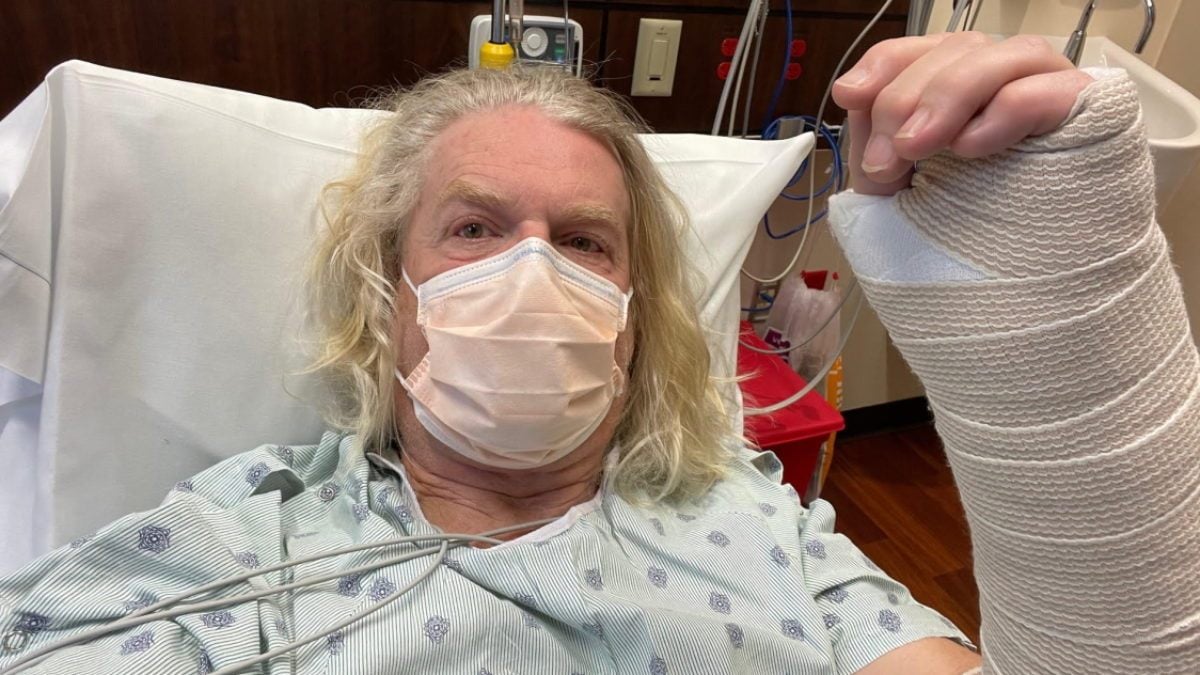 Dark Star Orchestra Guitarist Rob Eaton Breaks Wrist